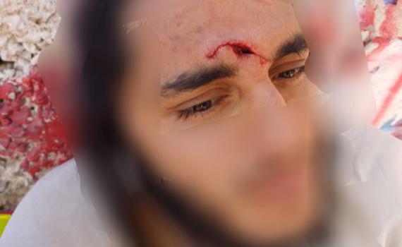 פיגוע אבנים חמור בחווארה: "נקלענו למארב מתוכנן"