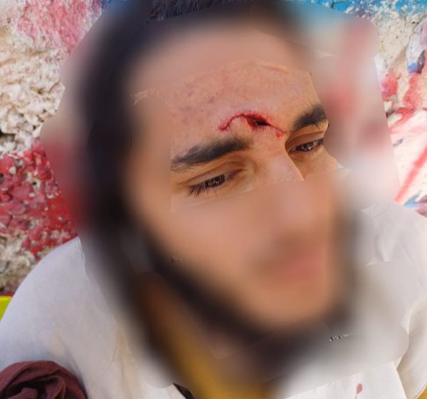 פיגוע אבנים חמור בחווארה: "נקלענו למארב מתוכנן"