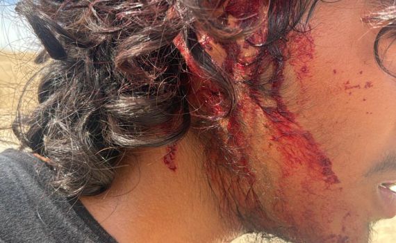 דיווח: ערבים תקפו רועי צאן יהודים ליד מבואות יריחו