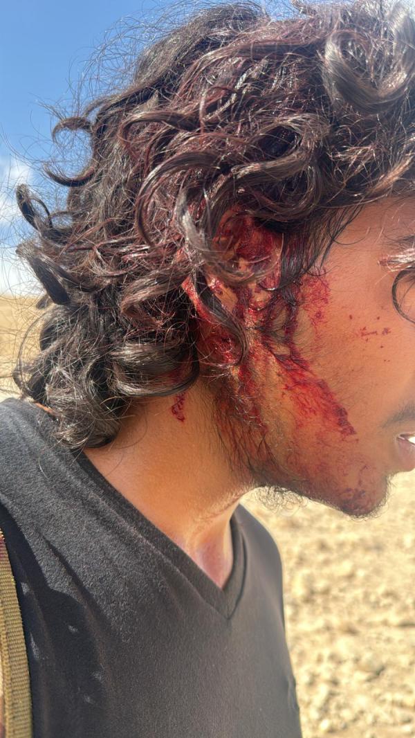 דיווח: ערבים תקפו רועי צאן יהודים ליד מבואות יריחו