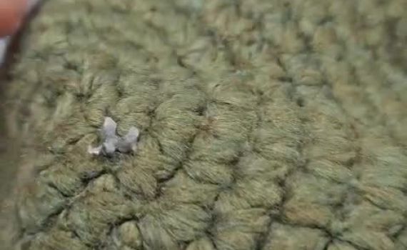 הכיפה עצרה את הרסיס; הפצוע לא נשרט