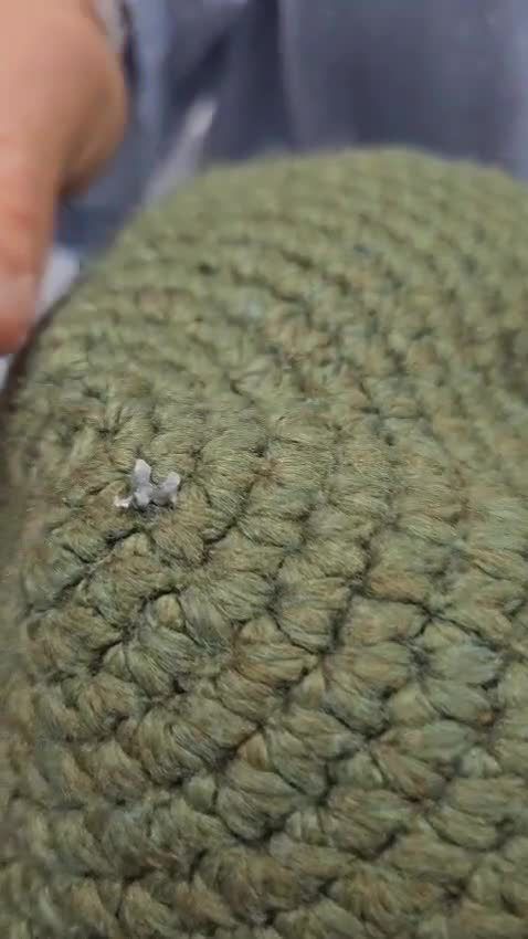 הכיפה עצרה את הרסיס; הפצוע לא נשרט