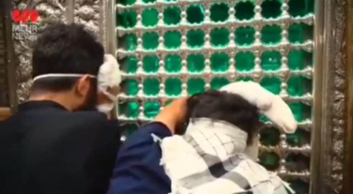 צפו: שורדי מתקפת הביפרים שנפצעו בתיעוד ראשון