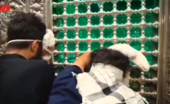 צפו: שורדי מתקפת הביפרים שנפצעו בתיעוד ראשון