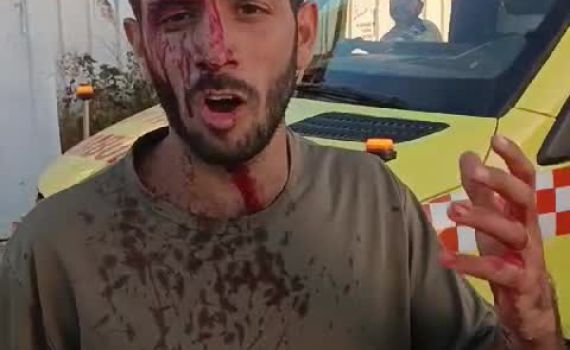 לינץ' בחוות העיטם: שעות אחרי שנשקו של בעל החווה הוחרם