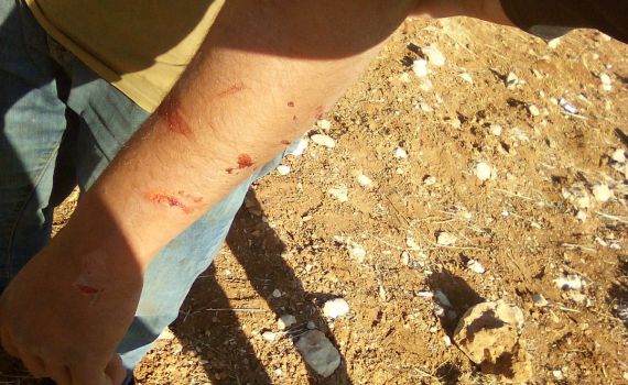 פורעים ערבים תקפו רועי צאן בבנימין, צה"ל עצר את היהודים