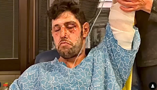 "הכרתי אותה בפאודה": עידן עמדי על האחות שטיפלה בו