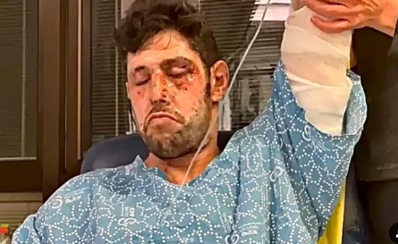 "הכרתי אותה בפאודה": עידן עמדי על האחות שטיפלה בו