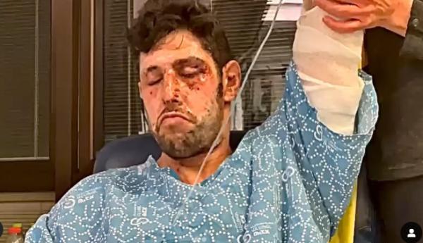 "הכרתי אותה בפאודה": עידן עמדי על האחות שטיפלה בו