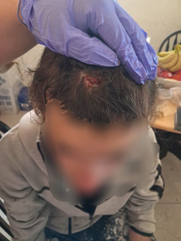 בחסות פעילי שמאל: 2 נערים יהודים הותקפו ע"י פלסטינים בסוסיא