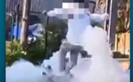 נער בן 17 קפץ על חבילת נפצים ונפצע באורח בינוני. צפו