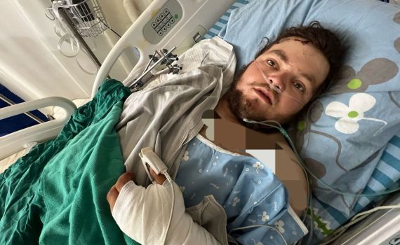 ניצול הפיגוע: "היה לי נס פורים – לטפל בתשתיות הטרור"