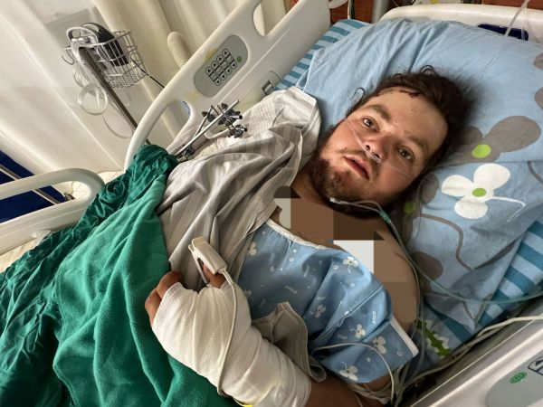 ניצול הפיגוע: "היה לי נס פורים – לטפל בתשתיות הטרור"