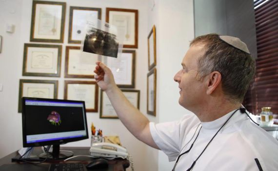 השתלות שיניים חדשניות: ד"ר ברוך עם 7 יתרונות מפתיעים