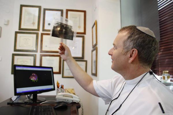 השתלות שיניים חדשניות: ד"ר ברוך עם 7 יתרונות מפתיעים