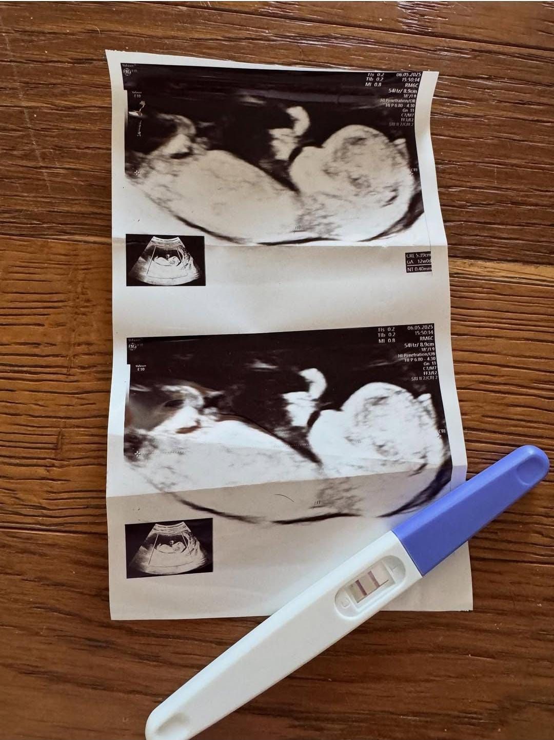 מאמנת הכושר חושפת הפלה: "3 מילים שלא אשכח – אין דופק, סליחה"