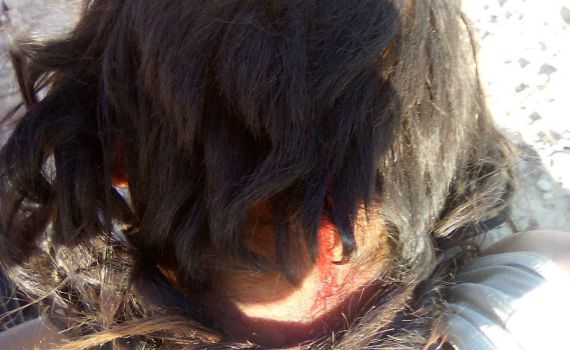 שבת של טרור ביו"ש: ערבים פגעו בבעל חווה ורועה