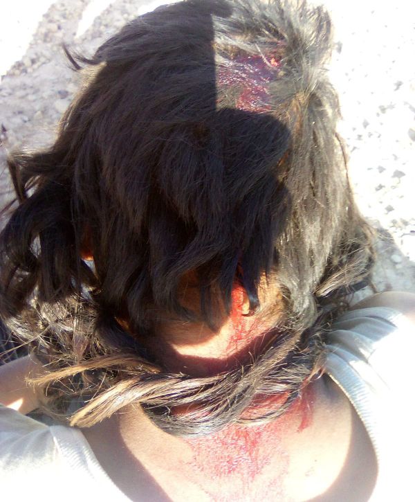 שבת של טרור ביו"ש: ערבים פגעו בבעל חווה ורועה