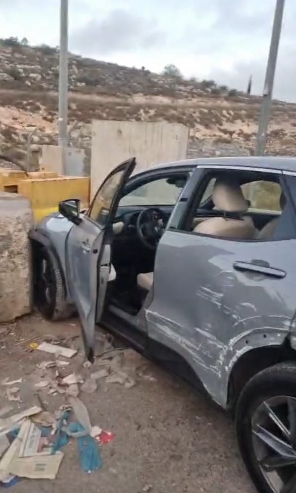 שינוי במצבו של התינוק הפצוע מהפיגוע