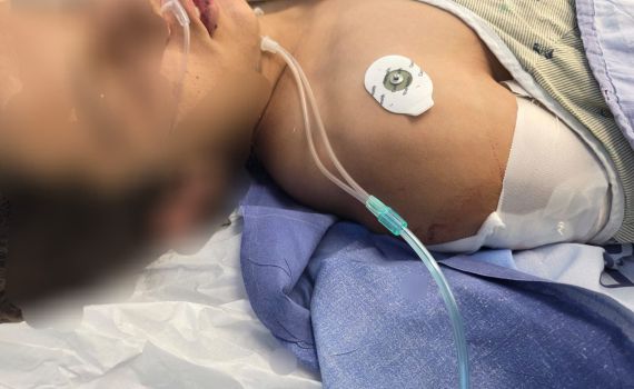 הפרט שדובר צה"ל הסתיר: נער בן 14 נפצע מהירי של החיילים