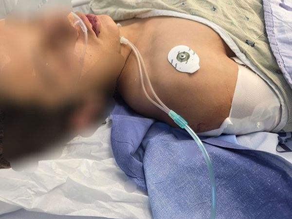 הפרט שדובר צה"ל הסתיר: נער בן 14 נפצע מהירי של החיילים