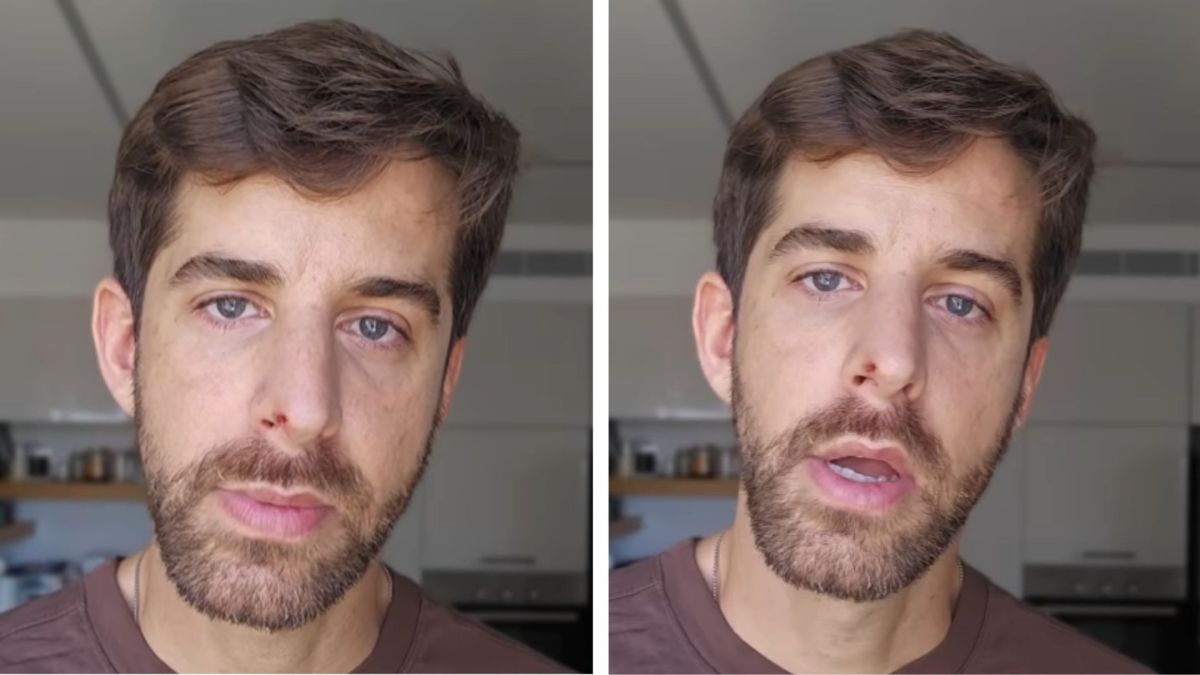 שחף רז מגן על הפיטבול: "לא רוצה לחיות בחברה שהורגת כלבים"