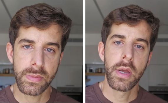 שחף רז מגן על הפיטבול: "לא רוצה לחיות בחברה שהורגת כלבים"