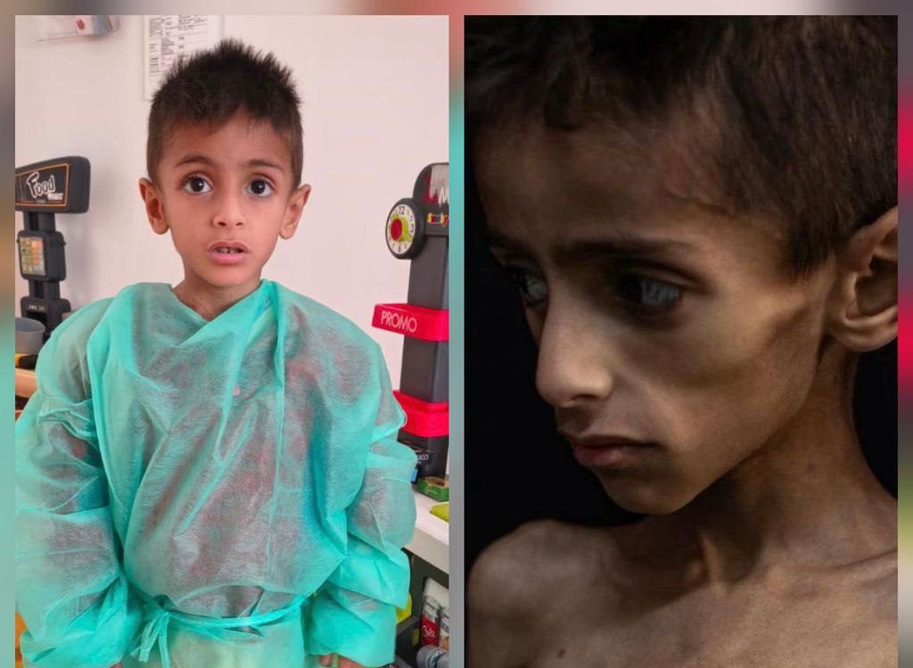 רעב בעזה? המתפ"ש מבהיר: "התמונה הוויראלית היא פייק"