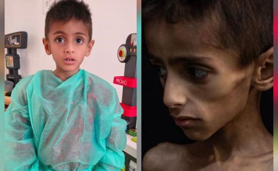 רעב בעזה? המתפ"ש מבהיר: "התמונה הוויראלית היא פייק"