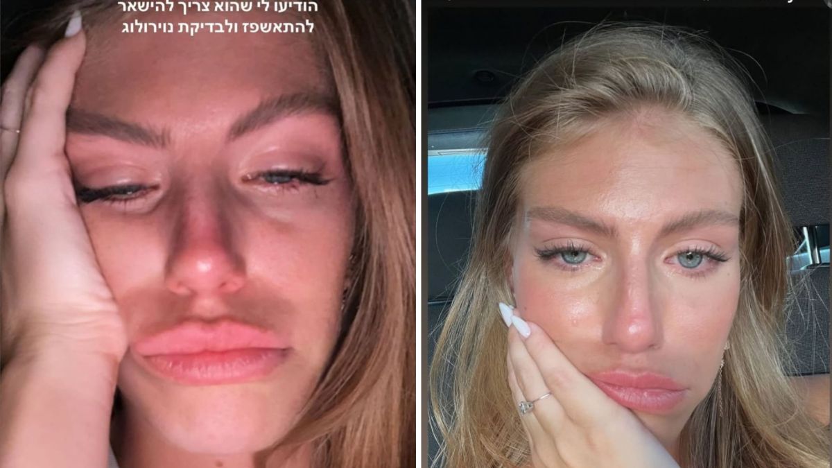 טיילור מלכוב: "טסתי לבית חולים, חוסר אונים"