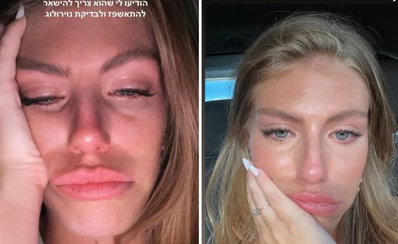 טיילור מלכוב: "טסתי לבית חולים, חוסר אונים"