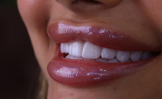 חיוך הוליוודי בירושלים: מרפאת המומחים של ד"ר הלל ברוך