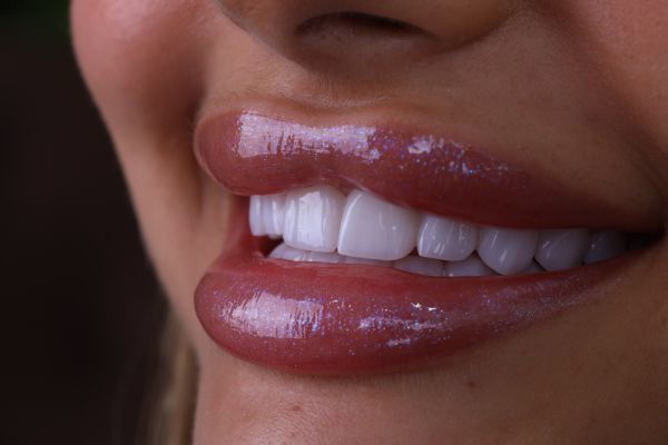 חיוך הוליוודי בירושלים: מרפאת המומחים של ד"ר הלל ברוך