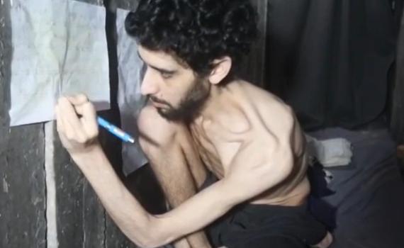 המשפחה התירה את פרסום הסרטון של אביתר דוד: "אין אוכל בכלל"