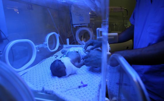 פג נפטר מזיהום חיידקי ברמב"ם; 3 פגים נוספים במצב יציב