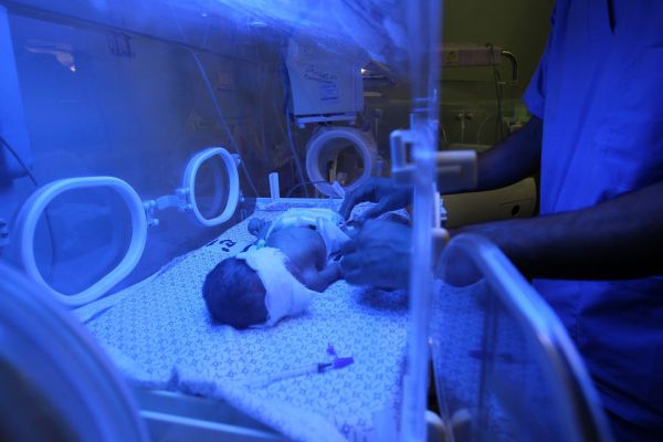 פג נפטר מזיהום חיידקי ברמב"ם; 3 פגים נוספים במצב יציב