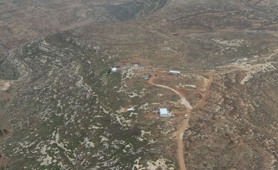 פועל ערבי של המנהל האזרחי תקף מתיישב  – ושוחרר ללא מגבלות