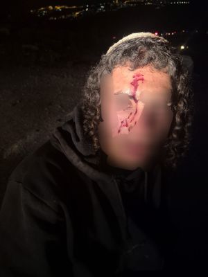 אירוע אלימות סמוך לענתות: פורעים ערבים תקפו רועי צאן