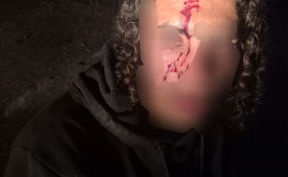 אירוע אלימות סמוך לענתות: פורעים ערבים תקפו רועי צאן