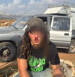 אירוע רודף אירוע: רועה צאן הותקף בבנימין ופונה לבית החולים