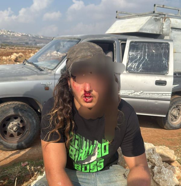 אירוע רודף אירוע: רועה צאן הותקף בבנימין ופונה לבית החולים