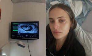 השחקנית שירה לוי משתפת בכאב: "לידה שקטה היא לא שקטה בכלל"