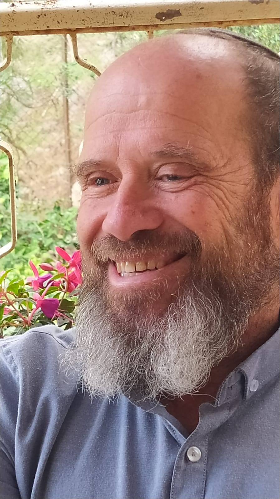 נאצלת היא תרומת אברים, אך לא זו המותנית במקבל